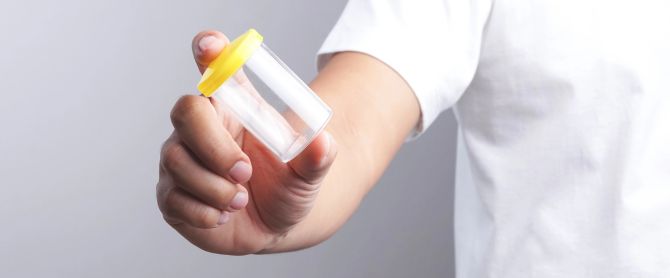 Does Kratom Show Up on a Drug Test? Detection Times and Testing Facts